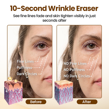 🔥Newyuo® Renewing 10s Wrinkle Serum