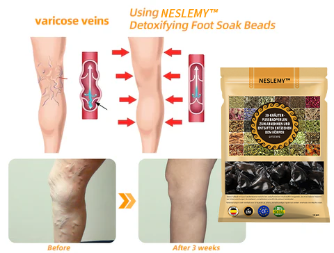 NESLEMY™ 30-Herb Slimming & Detox Foot Bath Beads-🦵👩‍⚕️(LANA Certification, Lymphatic Association of America)
