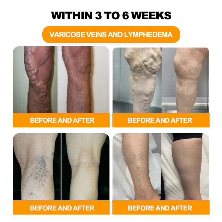 NESLEMY™ 30-Herb Slimming & Detox Foot Bath Beads-🦵👩‍⚕️(LANA Certification, Lymphatic Association of America)