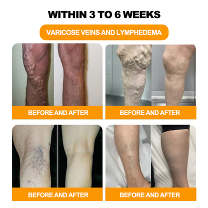 NESLEMY™ 30-Herb Slimming & Detox Foot Bath Beads-🦵👩‍⚕️(LANA Certification, Lymphatic Association of America)